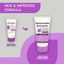Amlactin Ultra Smoothing Cream with 15% Lactic Acid AHA 140g