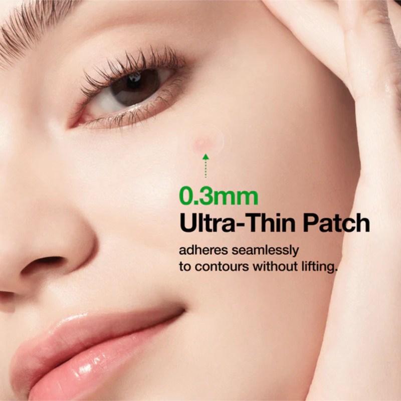 Anua Triple Acid Spot Care Microdart Patch 12 Patches