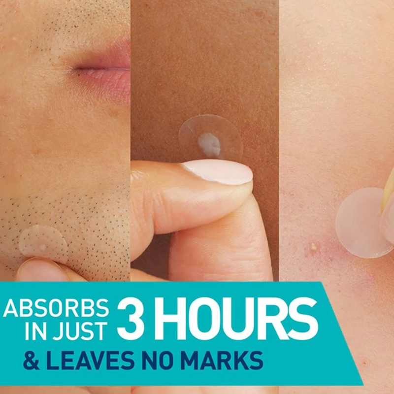 CeraVe Blemish Barrier Patches 22 Patches