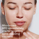 Cetaphil Gentle Clear Complexion Clearing Acne Cleanser 124ml