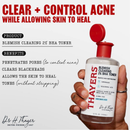 Thayers Blemish Clearing 2% BHA Toner 355ml
