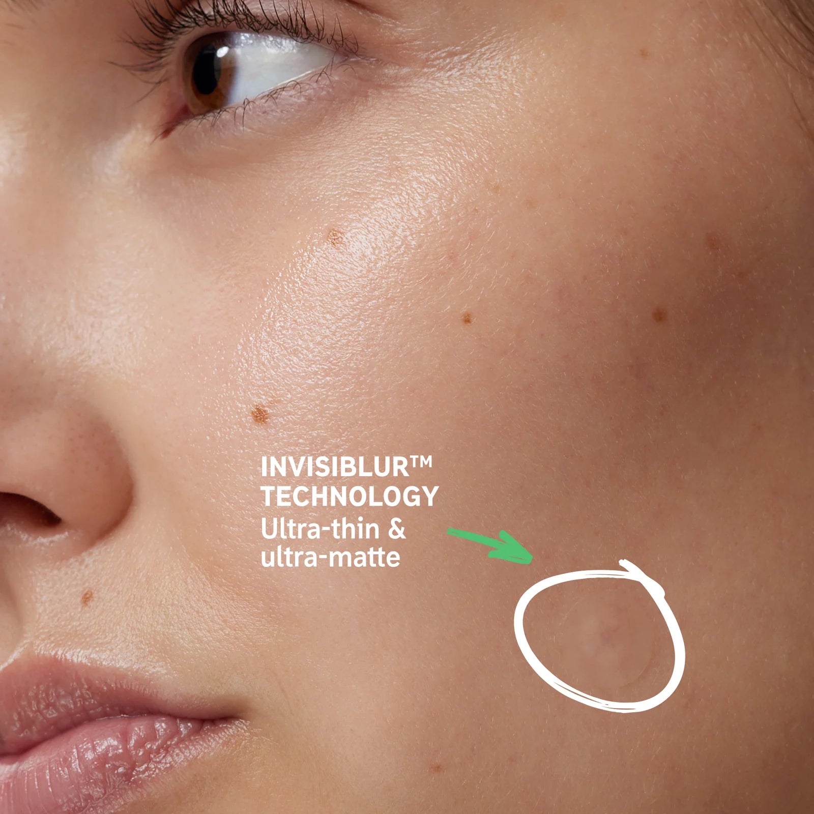 The Inkey List Hydrocolloid Invisible Pimple Patches 22 Patches | Acne Spot Treatment, Patches and Nose Strips The Inkey List Hydrocolloid Invisible Pimple Patches 22 Patches | Acne Spot Treatment, Patches and Nose Strips